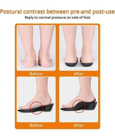 Cheaperzone Flat Foot Arch Support Shoes Insoles for Men & Women Medical Arch Support for Flat Feet Correction Orthopaedic Heel Pad Insoles, Legs Correction Pad for Various Sports Shoes Foot Pain Relief Product