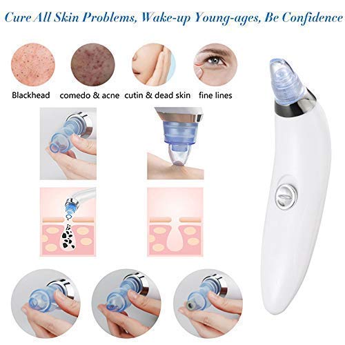 Cheaperzone  4 in 1 Multi-function Blackhead Remover Tools | Electric Derma suction Machine|Acne Pimple Pore Cleaner Vacuum tool-Device for Nose & Skin Care (Derma_Suction_Blackhead Remover-1)